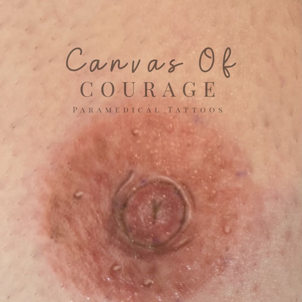 Close-up of a 3D areola tattoo